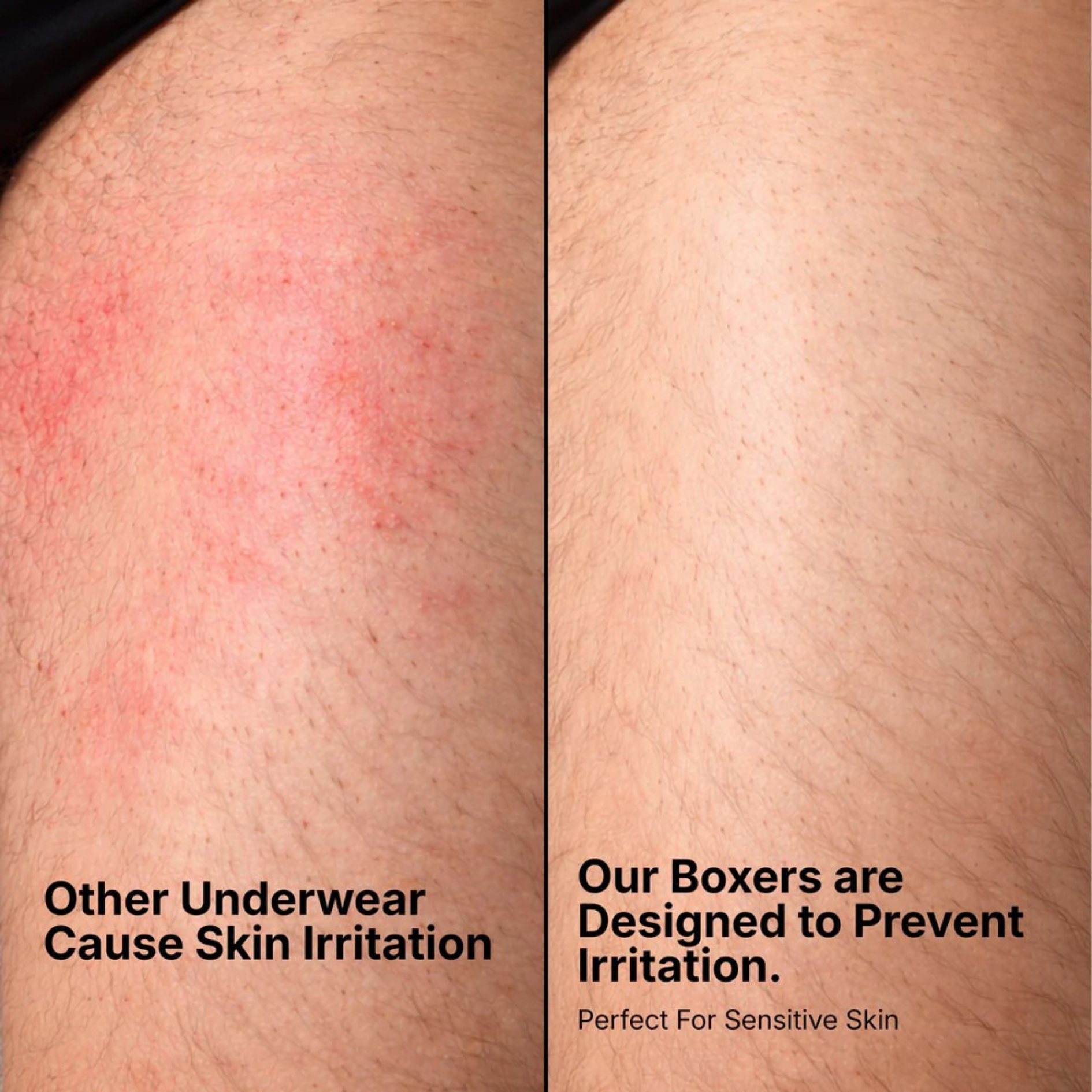 Hello Mesh Boxers 5-Pack Yellow | + 5 FREE